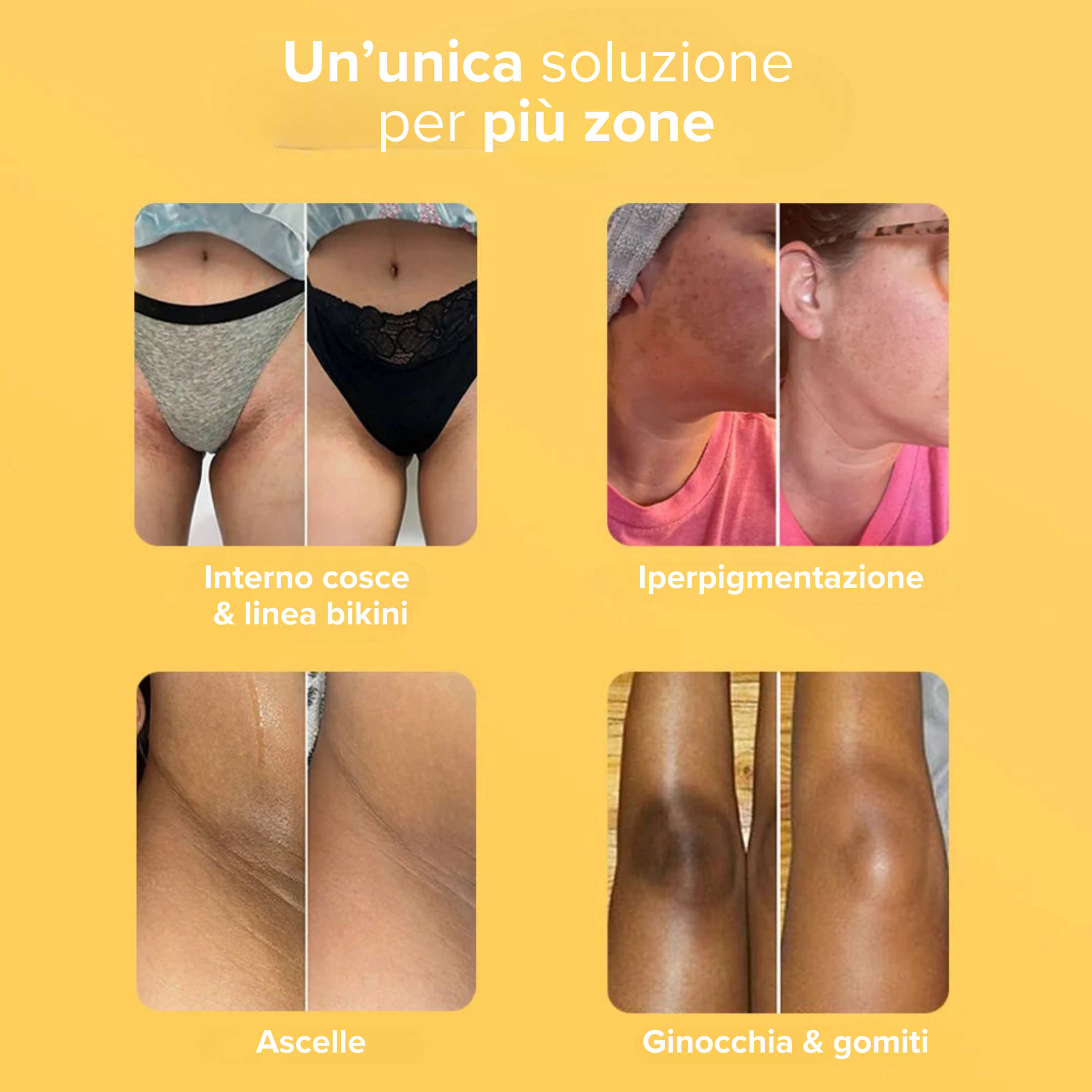 Saponetta alla Curcuma - Smacchia in soli 30 giorni!