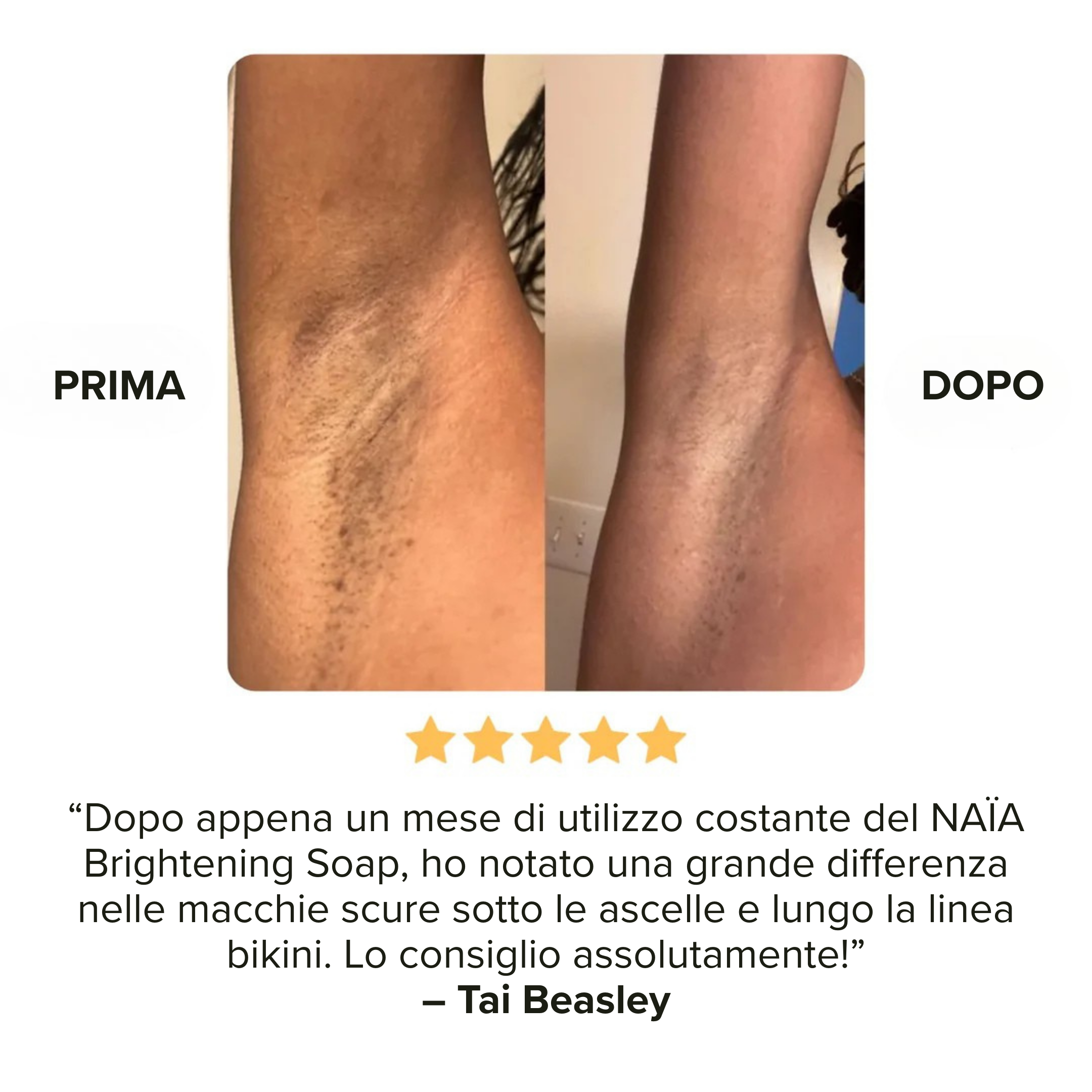 Saponetta alla Curcuma - Smacchia in soli 30 giorni!