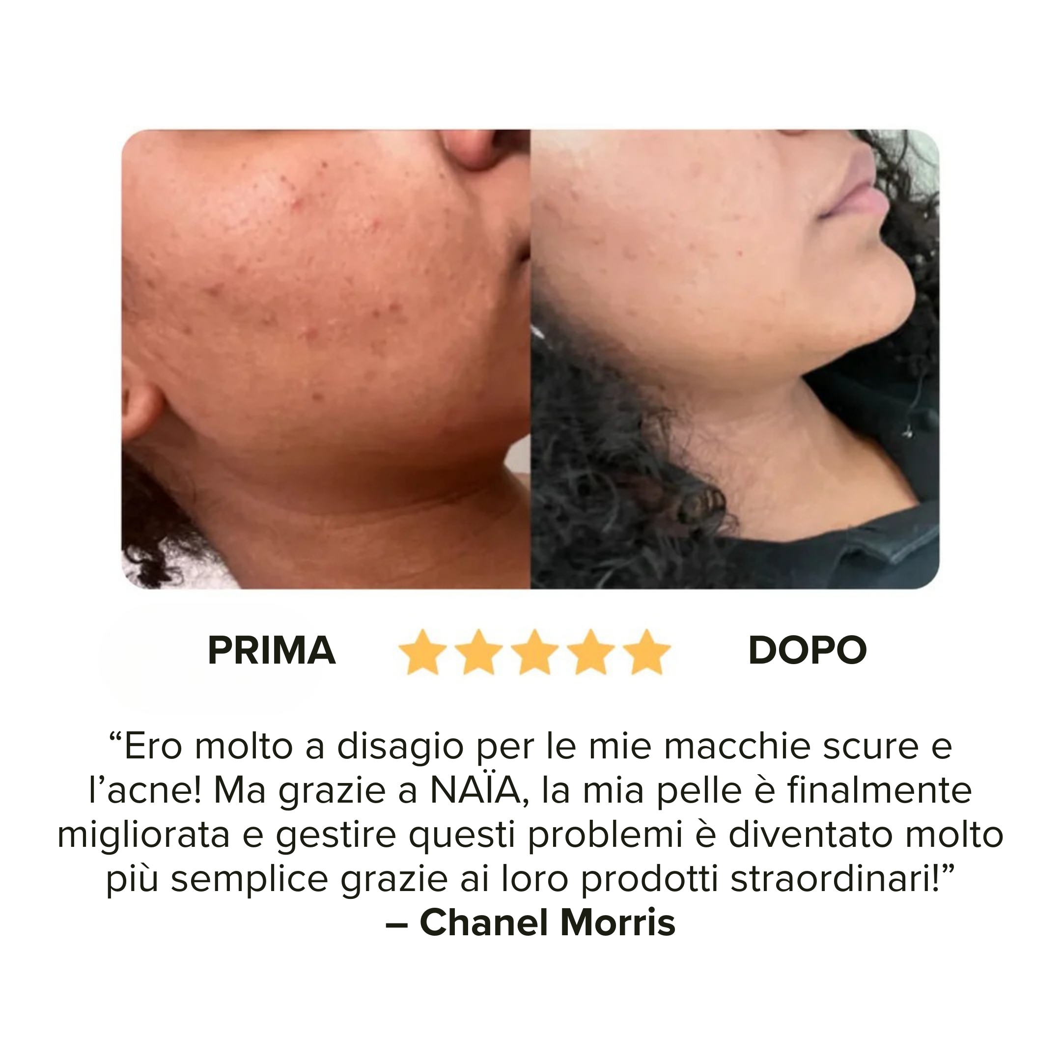 Saponetta alla Curcuma - Smacchia in soli 30 giorni!