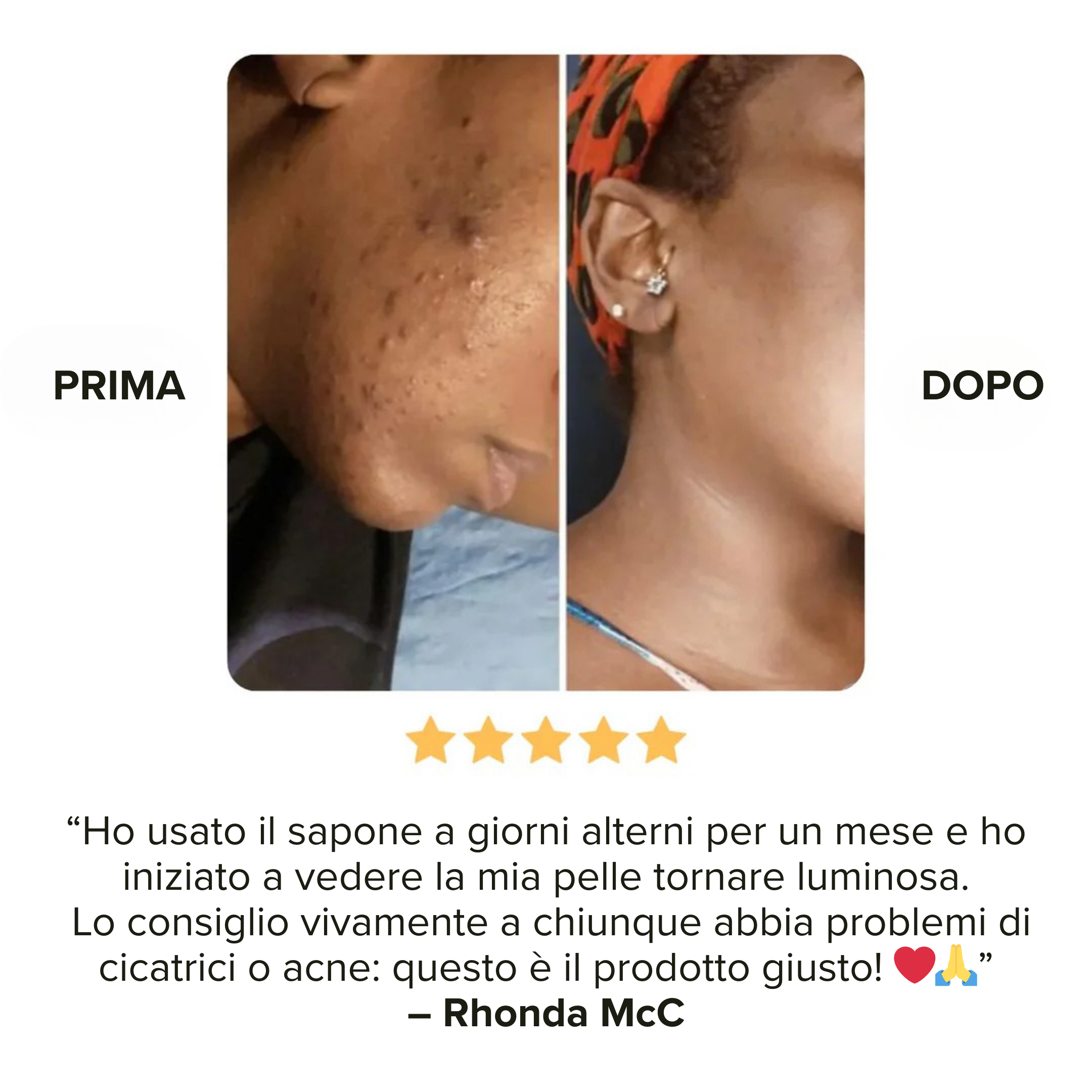 Saponetta alla Curcuma - Smacchia in soli 30 giorni!